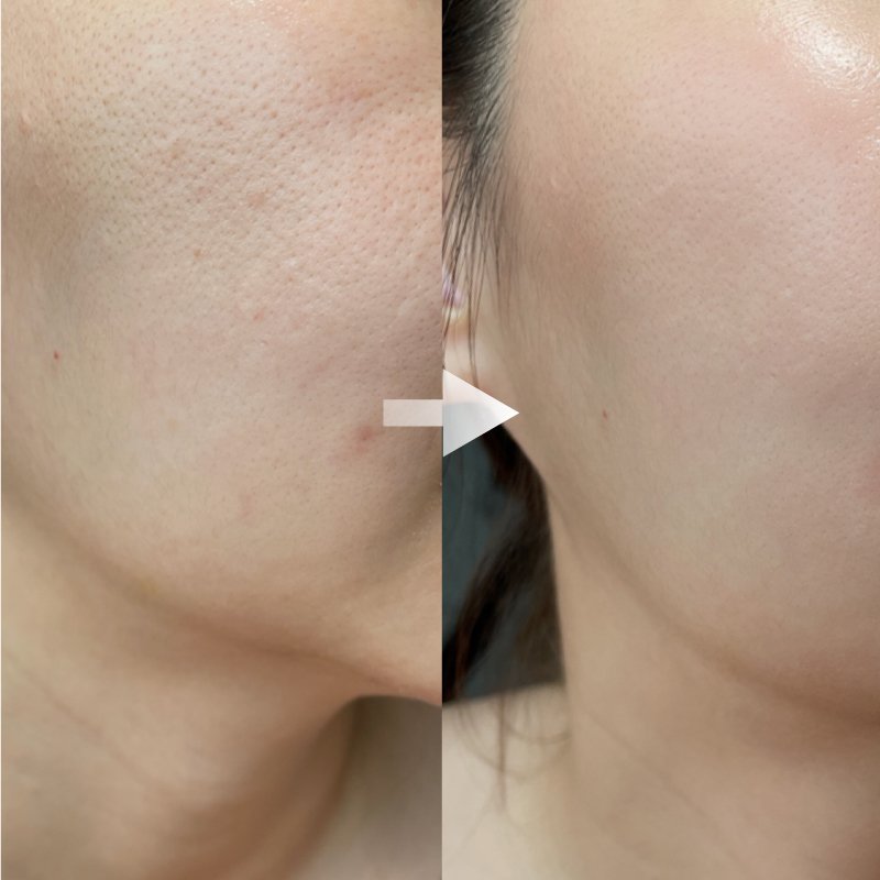 Bkind-Promotion-2-review-2