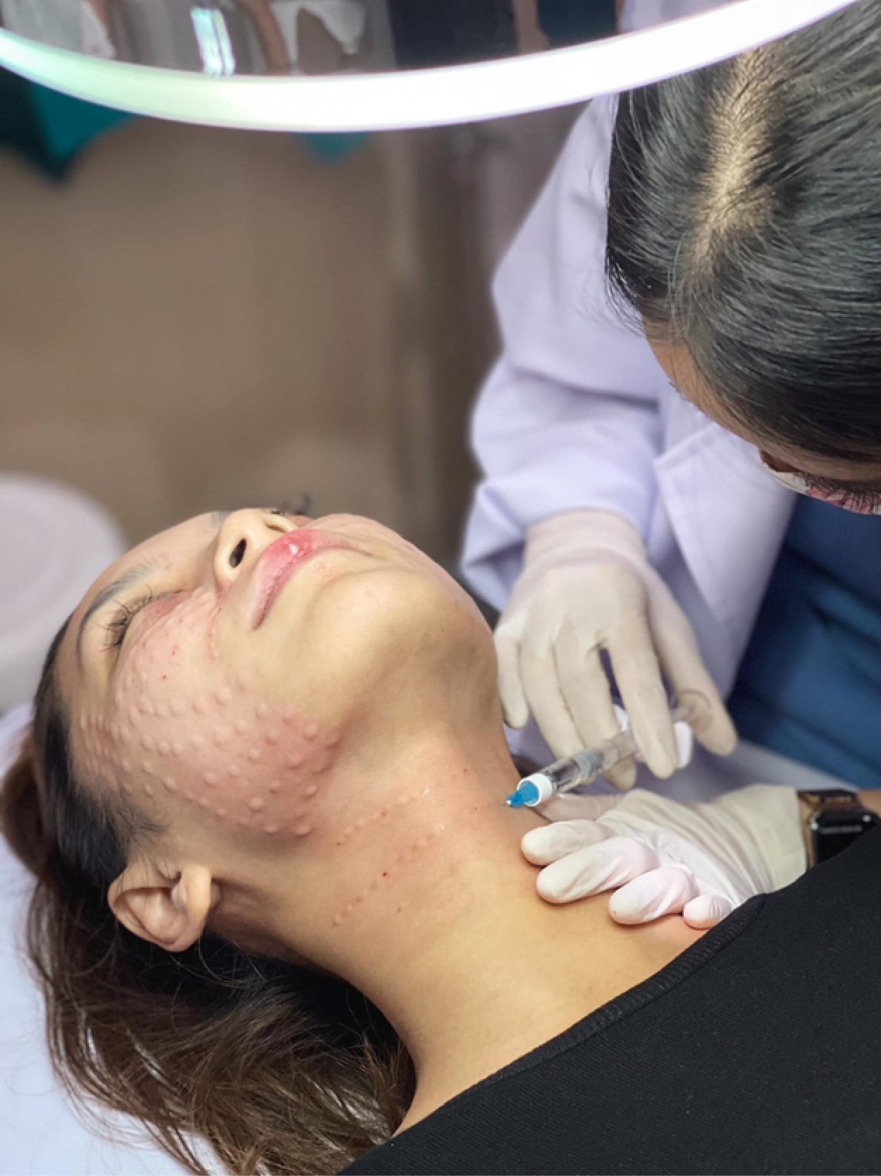 Bkind Rejuran chanel v2-1-06