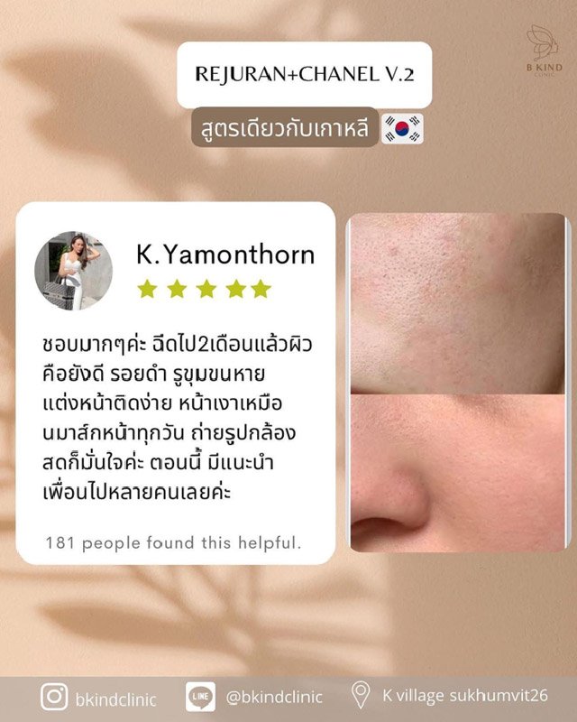 Bkind Rejuran chanel v2-07