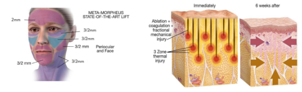 Morpheus Pro ช่วยอะไรบ้าง ?