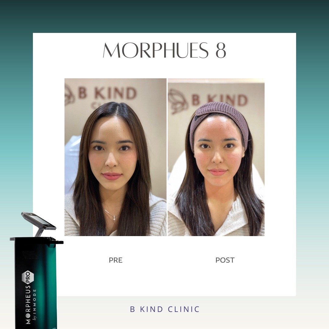 morpheus ช่วยอะไร