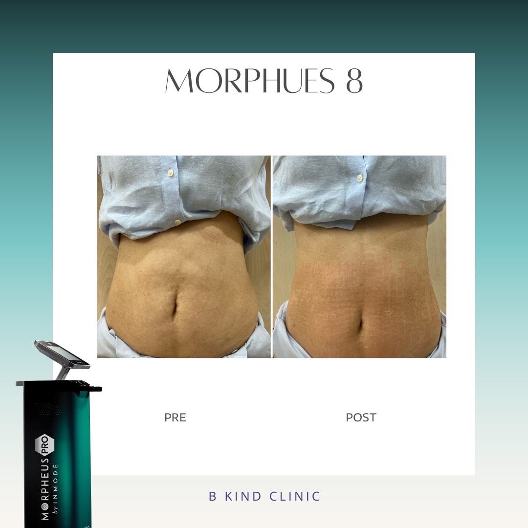 morpheus ที่ไหนดี