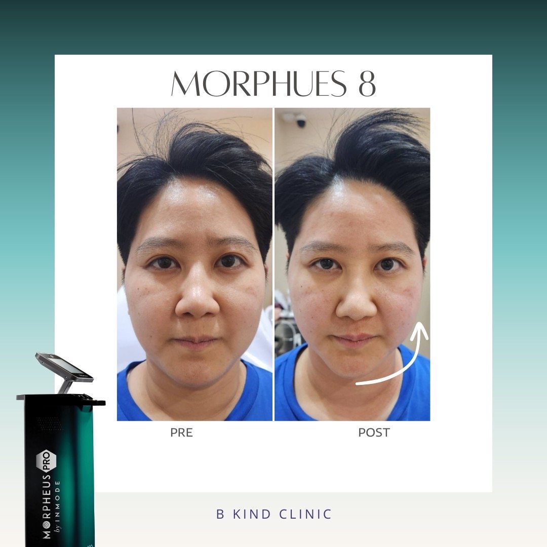 คลินิก morpheus