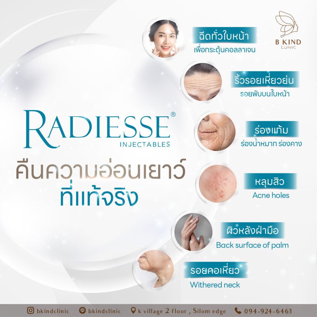 Radiesse ที่ไหนดี