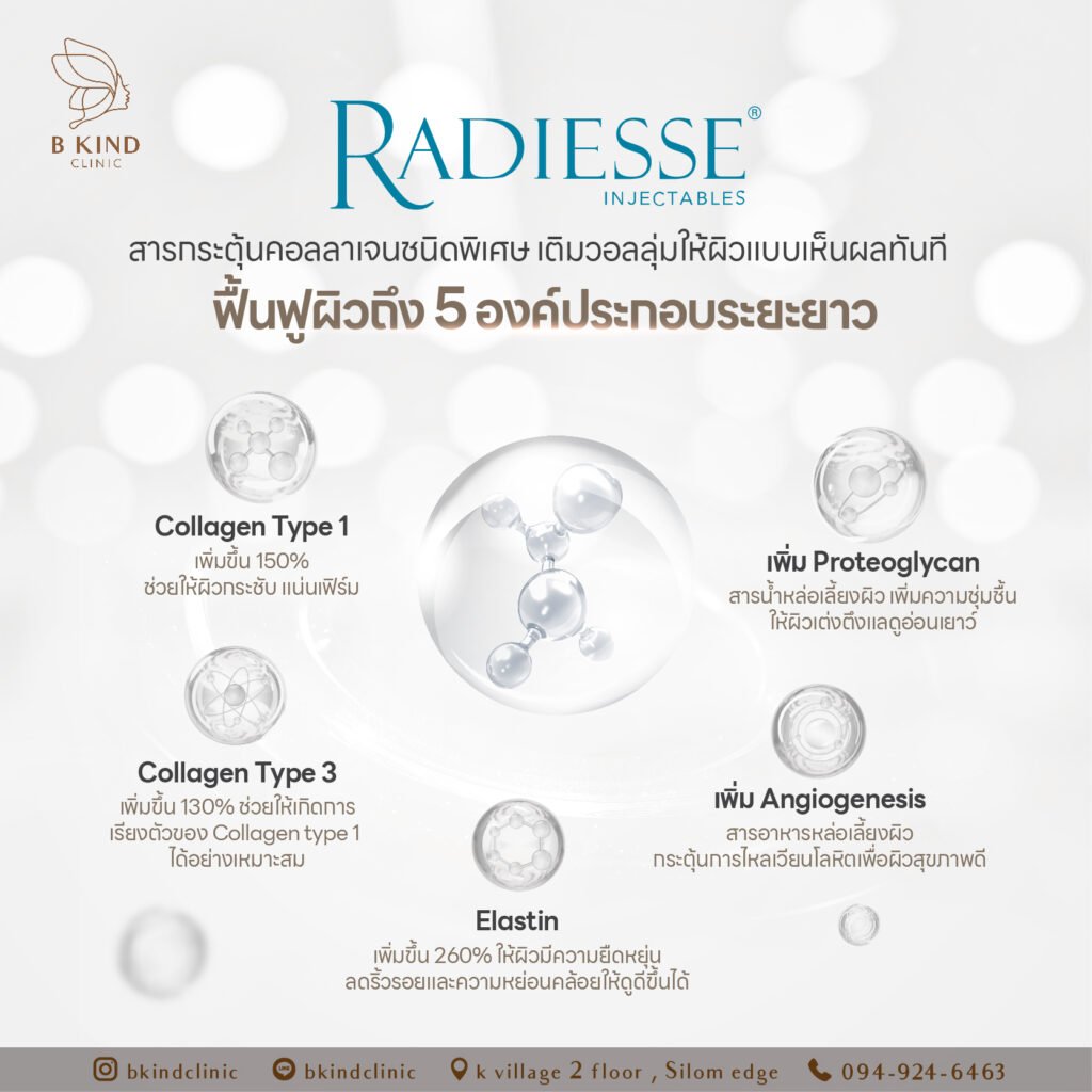 Radiesse ช่วยอะไร