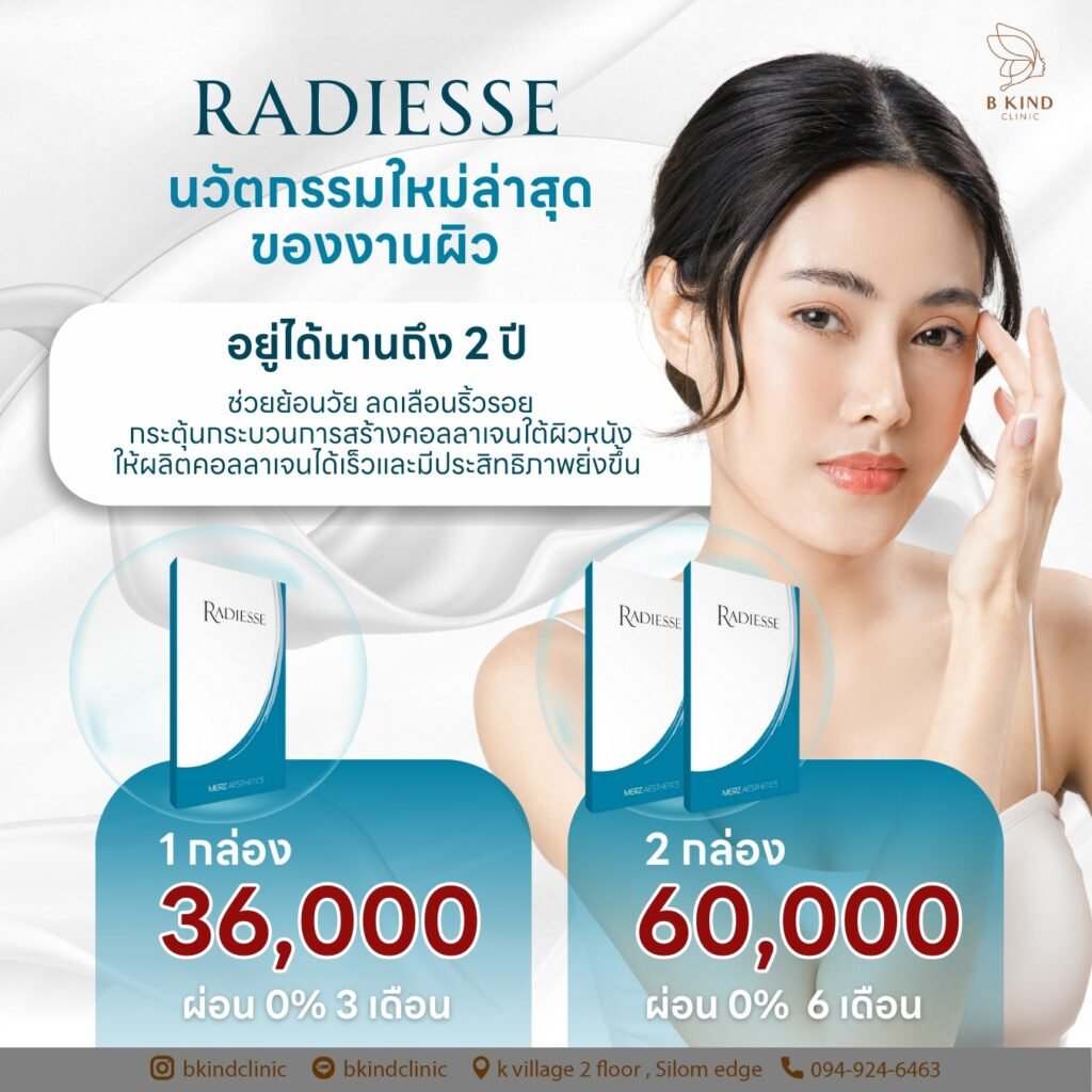 โปรโมชั่น RADIESSE